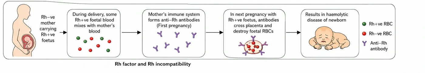 Sequence showing an Rh-negative mother carrying an Rh-positive foetus, mixing of foetal blood at delivery, formation of anti-Rh antibodies, antibodies crossing the placenta in the next pregnancy and haemolytic disease of the newborn