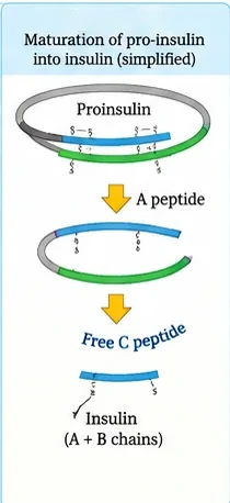 Proinsulin as a single chain folded with disulphide links; the C peptide is removed, leaving insulin made of A and B chains joined by disulphide bridges