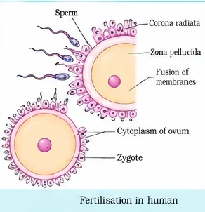 Several sperms approaching an ovum surrounded by corona radiata and zona pellucida, fusion of membranes, and the resulting zygote