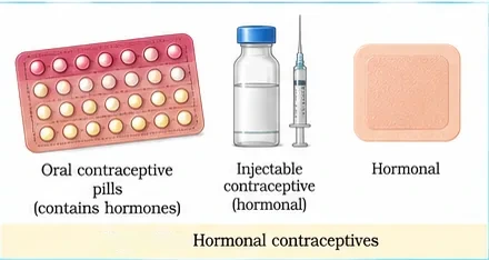 A blister pack of oral contraceptive pills, a vial and syringe for injectable hormonal contraceptive, and a hormonal patch