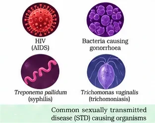 Four sexually transmitted disease pathogens: HIV virus particle, gonorrhoea-causing bacteria, the spiral Treponema pallidum causing syphilis, and the flagellated protozoan Trichomonas vaginalis