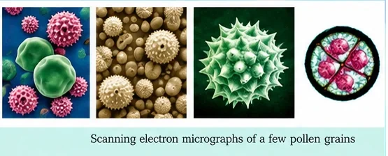 Scanning electron micrographs of several pollen grains with spiny and sculptured surfaces